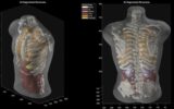 اسکن بدن بدون نیاز به دستگاه MRI / پروژه بلندپروازانه «میدجرنی مدیکال» اسکن بدن بدون نیاز به دستگاه MRI / پروژه بلندپروازانه «میدجرنی مدیکال»