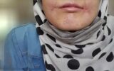 مرد مشهدی لبهای زن ۱۸ سالهاش را دوخت / فائزه به کلانتری پناه برد/ عکس مرد مشهدی لبهای زن ۱۸ سالهاش را دوخت / فائزه به کلانتری پناه برد/ عکس